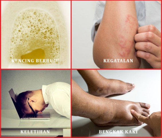 tanda-kegagalan-buah-pinggang-1